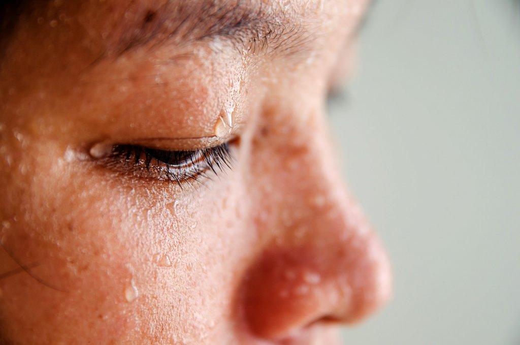Injection Botox contre Transpiration Montpellier, Traiter hyperhidrose
